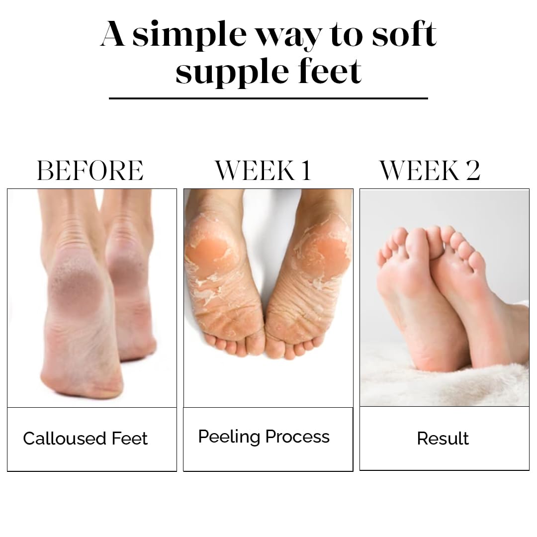 LuxaDerme Soft Feet Peeling Mask